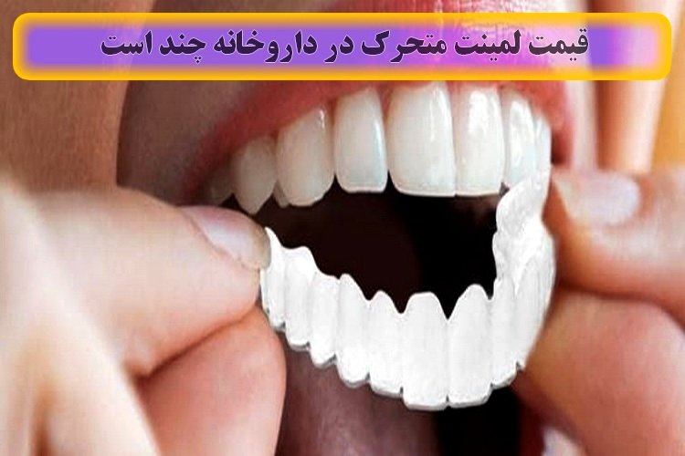 قیمت لمینت متحرک دندان در داروخانه